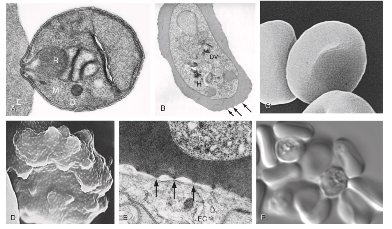 Electron and light microscopy images of Plasmodium parasites in erythrocytes